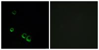 AVP Receptor V2 Polyclonal Antibody