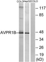 AVP Receptor V3 Polyclonal Antibody