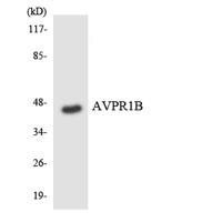 AVP Receptor V3 Polyclonal Antibody