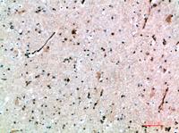 AVP Receptor V3 Polyclonal Antibody