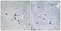 AZ1 Polyclonal Antibody