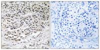 AZI1 Polyclonal Antibody