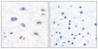 BACE Polyclonal Antibody