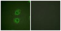 ErbB-3 Polyclonal Antibody