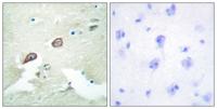 ErbB-3 Polyclonal Antibody