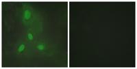 BACH1 Polyclonal Antibody