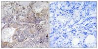 Bad Polyclonal Antibody