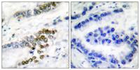 ERCC1 Polyclonal Antibody