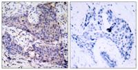 Bad Polyclonal Antibody