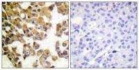 Bad Polyclonal Antibody