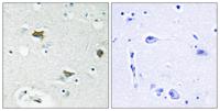 Bad Polyclonal Antibody