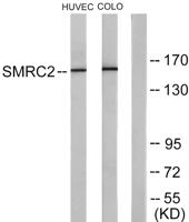 BAF170 Polyclonal Antibody