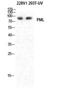 PML Polyclonal Antibody