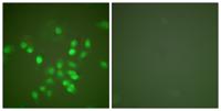 PML Polyclonal Antibody