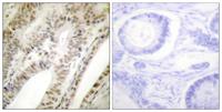 PML Polyclonal Antibody