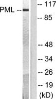 PML Polyclonal Antibody