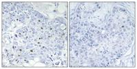 BAF250b Polyclonal Antibody