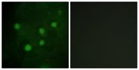BAF250b Polyclonal Antibody