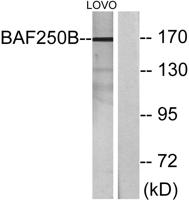 BAF250b Polyclonal Antibody