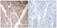 Bag-3 Polyclonal Antibody