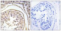 BAGE2 Polyclonal Antibody