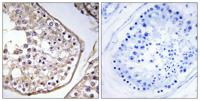 BAGE3 Polyclonal Antibody