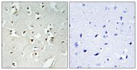 PMS1 Polyclonal Antibody