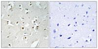 PMS1 Polyclonal Antibody