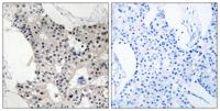 BAGE4 Polyclonal Antibody