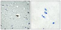 BAI-1 Polyclonal Antibody