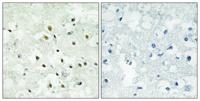 PMS2 Polyclonal Antibody
