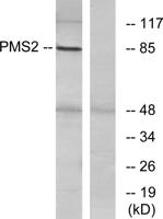 PMS2 Polyclonal Antibody
