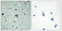 BAI-2 Polyclonal Antibody