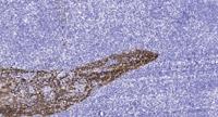 BAIAP2L2 Polyclonal Antibody