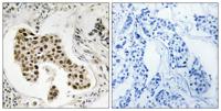 PMS2/PMS2CL Polyclonal Antibody