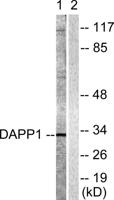 BAM32 Polyclonal Antibody
