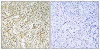 BARD1 Polyclonal Antibody