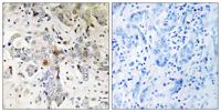 pNO40 Polyclonal Antibody