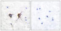 Bax Polyclonal Antibody