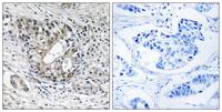 PNPase Polyclonal Antibody