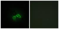 Bc10 Polyclonal Antibody