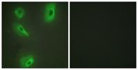 BCKDK Polyclonal Antibody
