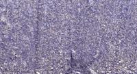 BCKDK Polyclonal Antibody