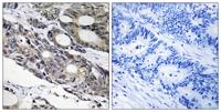 Bcl-10 Polyclonal Antibody