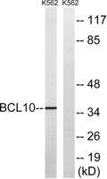 Bcl-10 Polyclonal Antibody