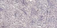 Podocan Polyclonal Antibody