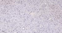 POLR1E Polyclonal Antibody