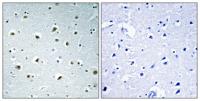 POLR2E Polyclonal Antibody