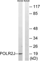 POLR2J1 Polyclonal Antibody
