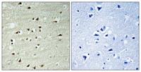 POLR3B Polyclonal Antibody